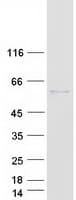 Human AHSG / Fetuin A Protein (Recombinant Myc-DDK (Flag))