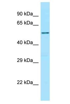 Polyclonal Rabbit anti-Human Ceramide Kinase / CERK Antibody (aa449-498, WB)