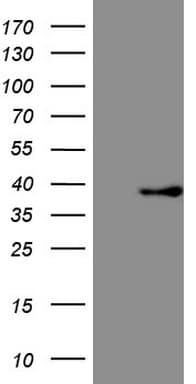 FBXO8 / FBX8 Antibody (aa1-231, clone OTI9G5)