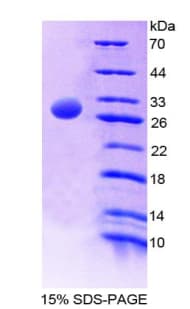 Mouse AMY2A / Pancreatic Amylase Protein (Recombinant His-T7)