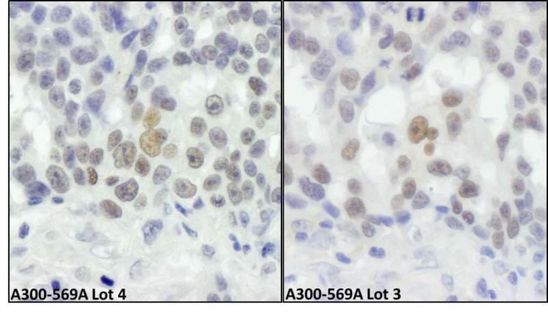 IHC-plus™ RIF1 Antibody (aa2425-C-term)