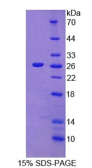 Mouse LGTN / EIF2D Protein (Recombinant His-T7)