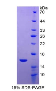 Human FABP7 / BLBP / MRG Protein (Recombinant His)