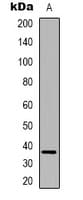 FAM84B Antibody (N-Terminus)