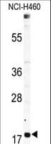 Polyclonal Rabbit anti-Human RPL23A Antibody (aa44-73, WB)