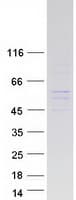 Human GABPB2 Protein (Recombinant Myc-DDK (Flag))