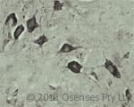 Polyclonal Rabbit anti-Rat VPS45 Antibody (Internal, IHC, WB)