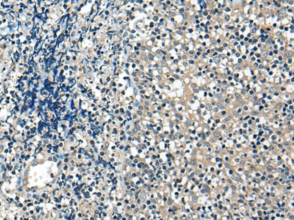USP12 Antibody