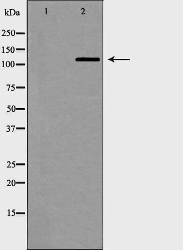TERT / Telomerase Antibody (phospho-Ser824)