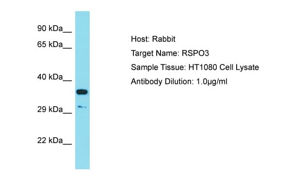 RSPO3 Antibody (aa202-251)