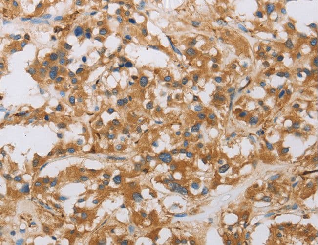 RAD54L2 Antibody