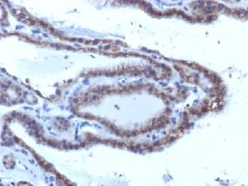 TSH Receptor / TSHR Antibody (clone SPM223, Azide-free, BSA-free)
