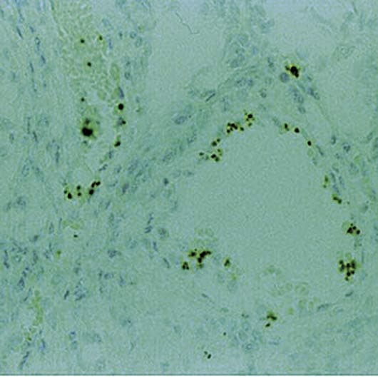 THBS1 / Thrombospondin-1 Antibody (clone A6.1)