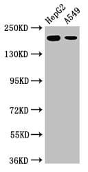 Polyclonal Rabbit anti-Human LRRK1 Antibody (WB)
