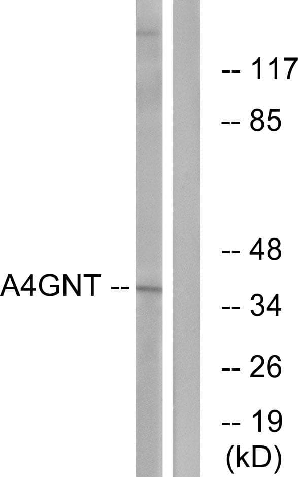 Alpha4GnT / A4GNT Antibody