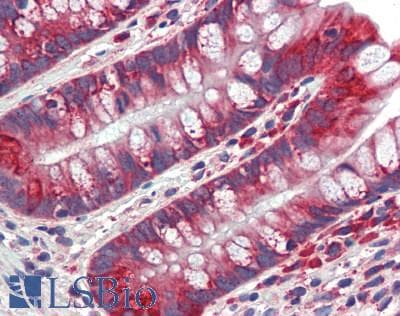 EPO / Erythropoietin Antibody (aa28-192)