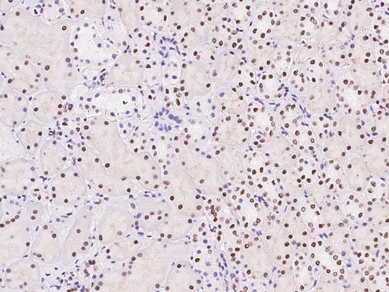 TPRX1 Antibody