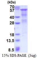 Human HPSE / Heparanase Protein (Recombinant His)