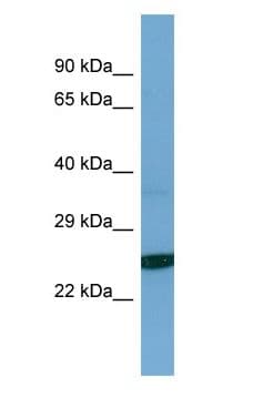 TESC Antibody (aa125-174)