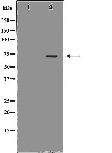 LBR / Lamin B Receptor Antibody