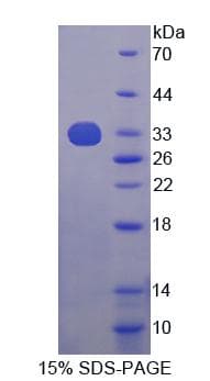 Human YWHAQ / 14-3-3 Theta Protein (Recombinant His-T7)