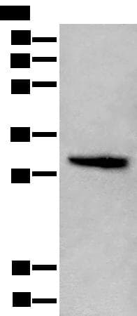 HIST1H1C Antibody