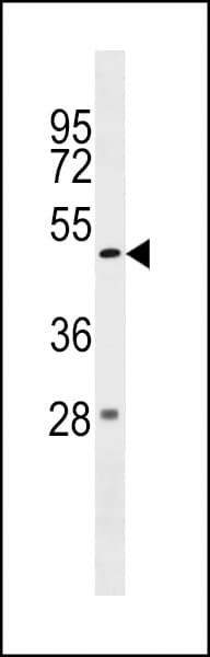 ZBTB47 Antibody (aa191-218)