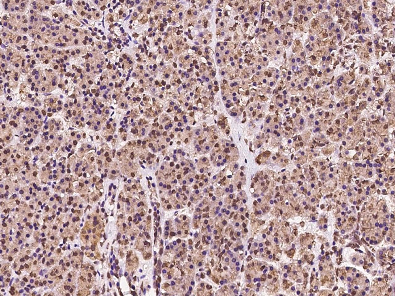 Polyclonal Rabbit anti-Human MAN2B2 Antibody (IHC)