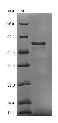 Bacteroides fragilis htpG Protein (Recombinant 10His-SUMO, N-terminus + Myc, C-terminus)