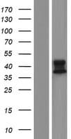 ALDH3B2 Protein (Over-Expression Lysate Myc-DDK (Flag))
