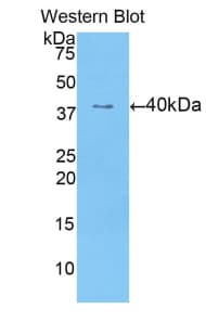 CCK / Cholecystokinin Antibody (aa1-115)