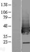 Human TALDO1 / Transaldolase 1 Protein (Over-Expression Lysate Myc-DDK (Flag))