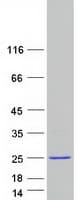 Human HMGIY / HMGA1 Protein (Recombinant Myc-DDK (Flag))