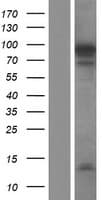 NUTM2F / FAM22F Protein (Over-Expression Lysate Myc-DDK (Flag))