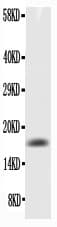 CSF2 / GM-CSF Antibody (aa18-141)