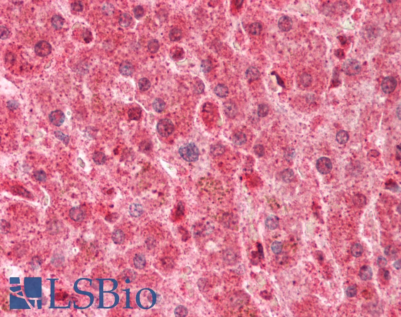 Polyclonal Rabbit anti-Human LPL / Lipoprotein Lipase Antibody (aa313-362, IHC, WB)