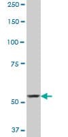 SP110 Antibody (clone 8C8)