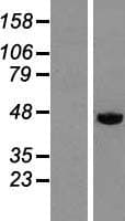 DEK Protein (Over-Expression Lysate Myc-DDK (Flag))