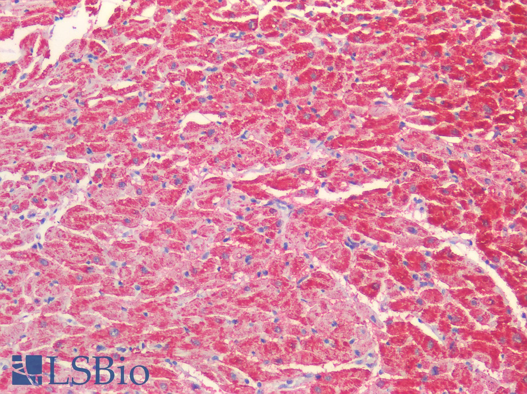 IHC-plus™ VDAC2 Antibody