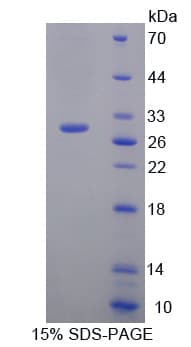 Human IL17RC Protein (Recombinant His-T7)