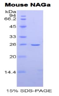 Mouse NAGA Protein (Recombinant His)