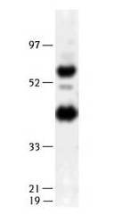 LIPG / Endothelial Lipase Antibody (N-Terminus, DY650)