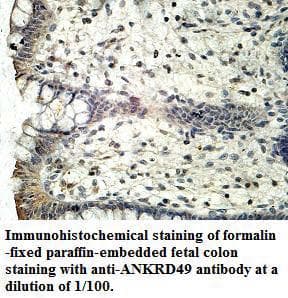 Polyclonal Rabbit anti-Human ANKRD49 Antibody (aa2-239, IHC, WB)
