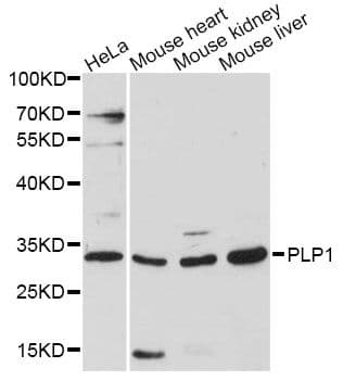 PLP1 / Myelin PLP Antibody