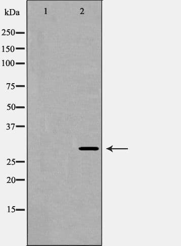 KCNIP3 / Dream / Calsenilin Antibody