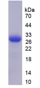 Human THBS2 / Thrombospondin 2 Protein (Recombinant His-T7)