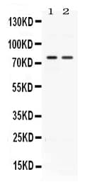ACVR2 / ACVR2A Antibody