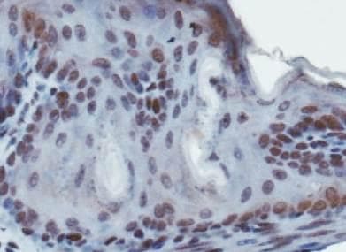 SUV420H1 Antibody (aa100-150)