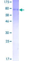 Human GRN / Granulin Protein (Recombinant GST)