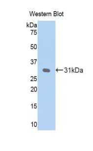 CRP / C-Reactive Protein Antibody (aa20-225)